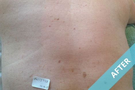 torso_2